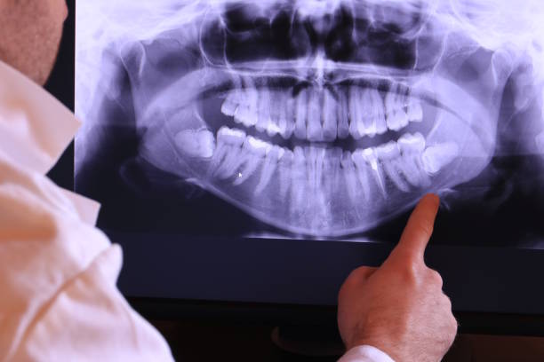 Best Emergency Denture Repair in Calais, ME