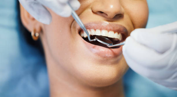 Best Emergency Dental Care for Broken or Chipped Teeth in Calais, ME