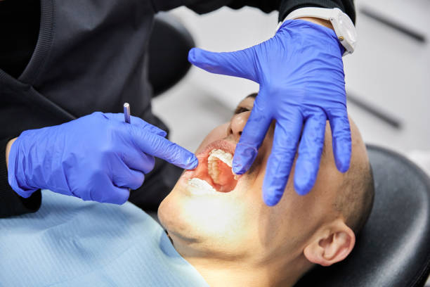 Best Emergency Root Canal Treatment in Calais, ME